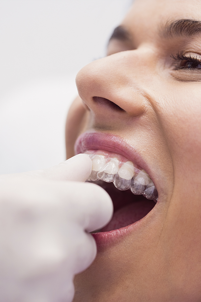Alineadores Dentales Dentista Doctor Vainer